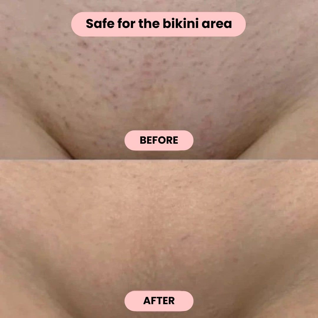 Intimate Hair Trimmer | Electric Razor for Women | FemmeGlide