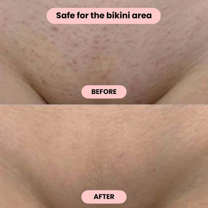 Intimate Hair Trimmer | Electric Razor for Women | FemmeGlide